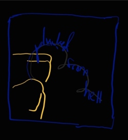 Fundraising Page Image